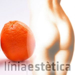 piel-de-naranja-celulitis-lleida-linia-estetica